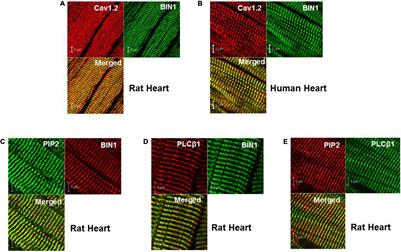 Phosphatidylinositol-4,5-Bisphosphate Binding to Amphiphysin-II Modulates T-Tubule Remodeling: Implications for Heart Failure
